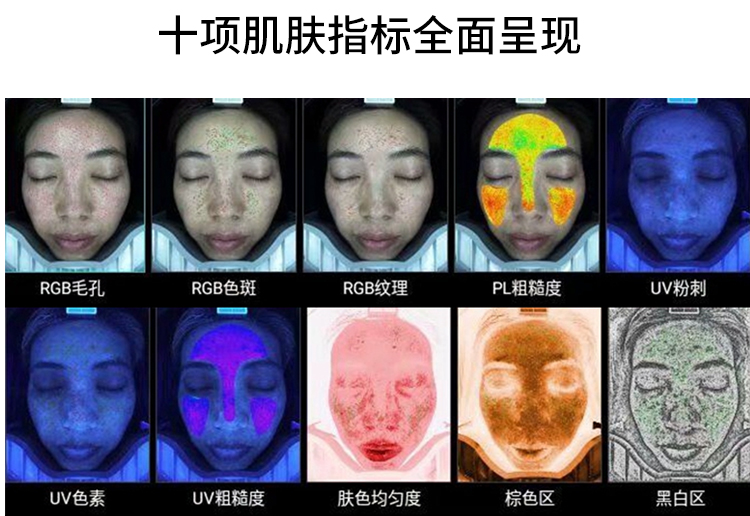 皮肤检测仪的十种检测体例